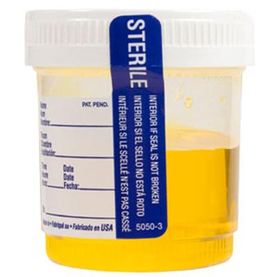 Click to get Urine Pee Sample Candy